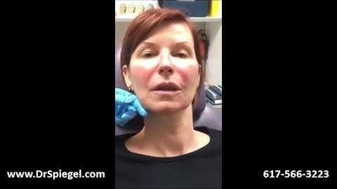 Restylane Defyne & Refyne Injections Video - The Spiegel Center