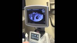 Ducky's 1st ultrasound