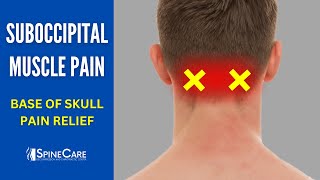 How to Fix Suboccipital Muscle Pain | BASE OF SKULL Pain Relief