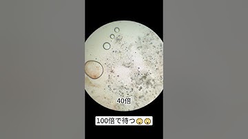 ニンジンを400倍に拡大するのは本当にクールだ！   #microscope #science #sciencemicroscope