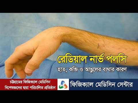 ভিডিও: রেডিয়াল রেভার কার্বন 1.1 105 পর্যালোচনা