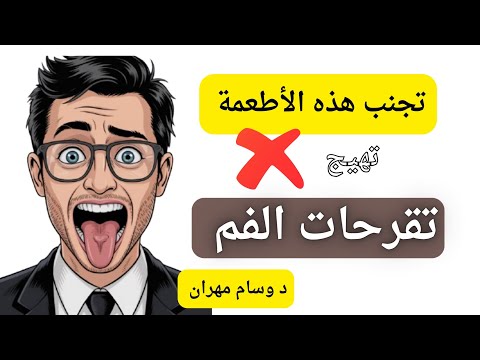 تجنب هذه الأطعمة في قرح الفم