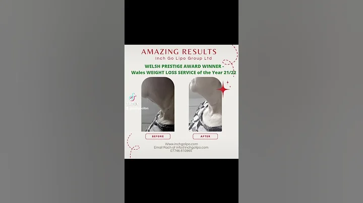 Look at These Results!!! #ultrasoundcavitation #fatreduction #beauty #cavitation #lipocavitation