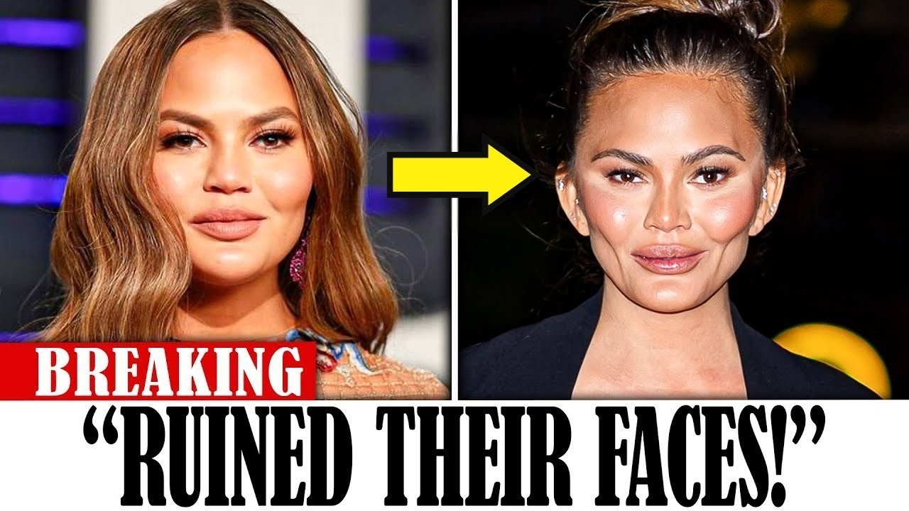 Celebrities Who Destroyed Their Faces With Buccal Fat Removal!