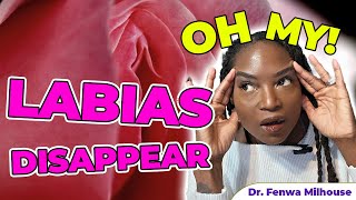 ARE YOUR LABIA DISAPPEARING? | Dr. Milhouse