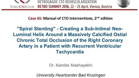 Case 65: Manual of CTO Interventions - Severely calcified RCA CTO