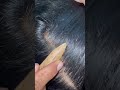 #fypviralシ #fyp #lice #hair #LiceOnHead #liceremoval #brasil #xyzbcafyp #licecomb #kutu #booyah