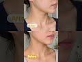 The Hidden Cause of Neck Wrinkles (And How to Fix It!) 📱😩