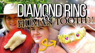 Bottle digging with friends! Diamond ring and a human tooth found in 100 year old rubbish dump!