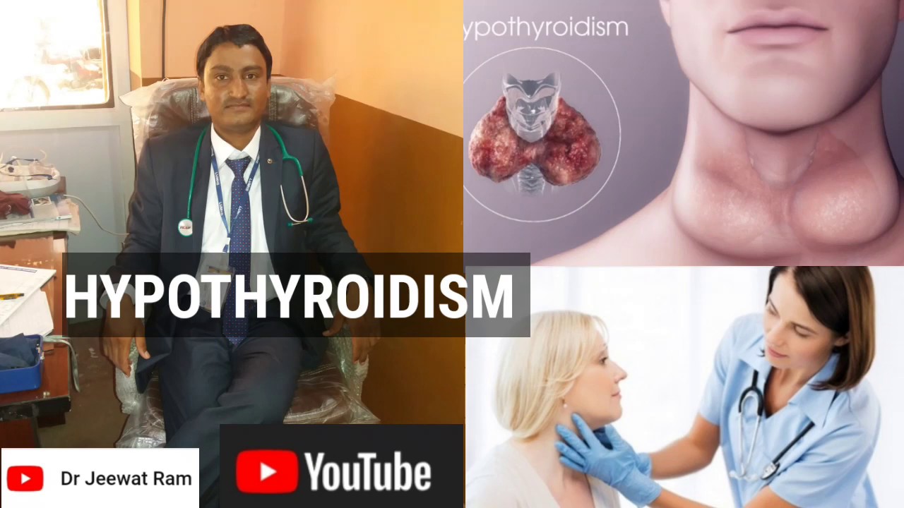 HYPOTHYROIDISM, CAUSES, SIGNS, SYMPTOMS, DIAGNOSIS AND TREATMENT - YouTube