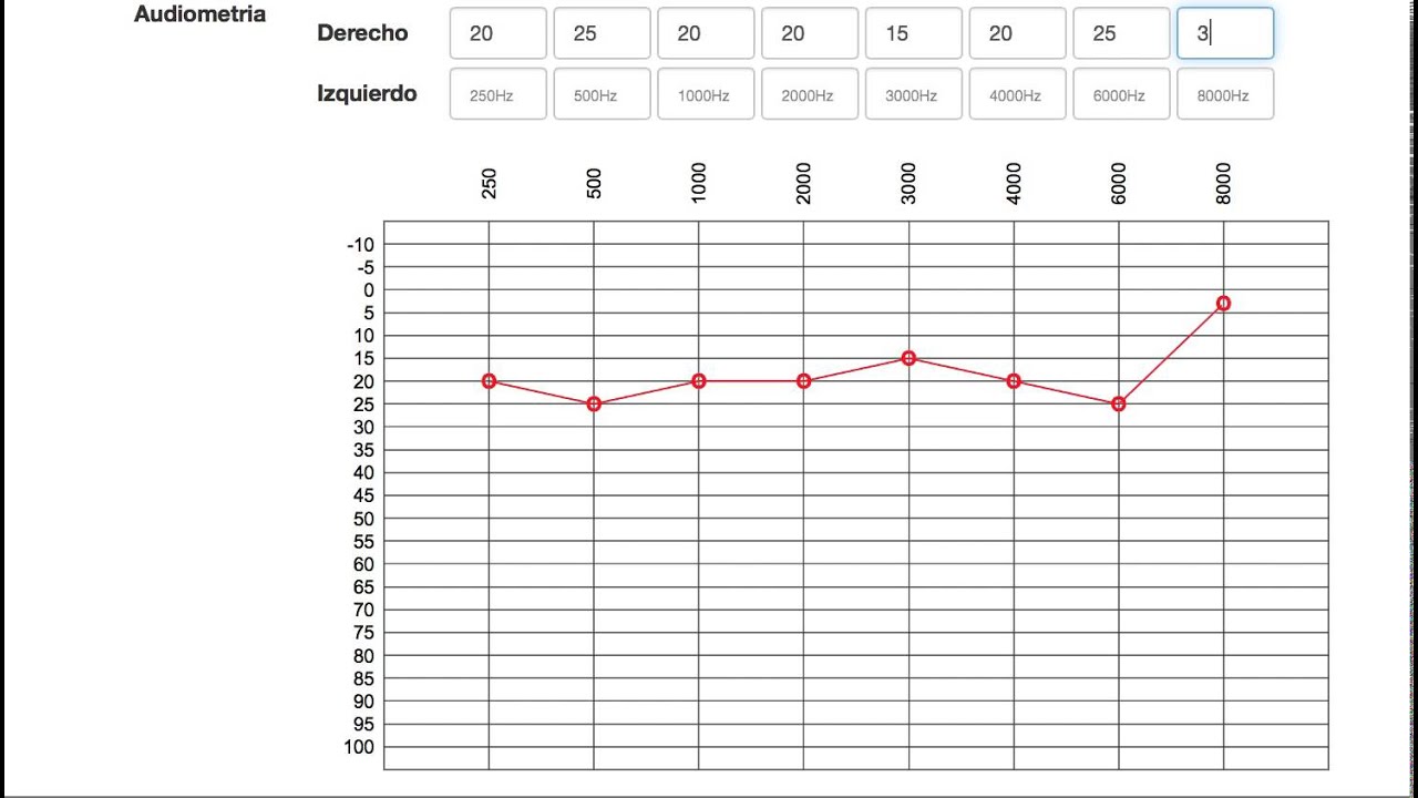 audiograma