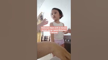 Thumbnail of Obat gatal Alergi Campak atau Biduran dengan rebusan Daun sirih & garam #obattradisional #herbal #fy