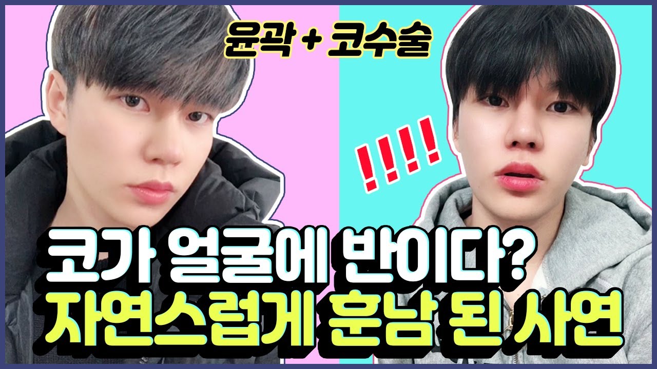 윤곽+코수술│코랑 광대가 슬림해졌죠? 각은 살리고 줄일건 확 줄인 남자성형 6개월 후기