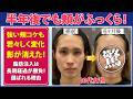 【症例紹介】友達にコケを指摘された...|1回で驚愕のビフォーアフター