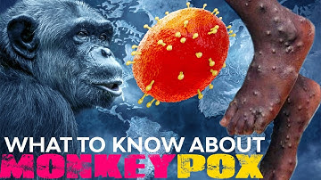 Monkeypox Explained : What To Know About Monkeypox