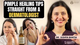 Pimple Healing Guide: Spot Treatments, Patches & Mistakes to Avoid || Dr. Sarin ||
