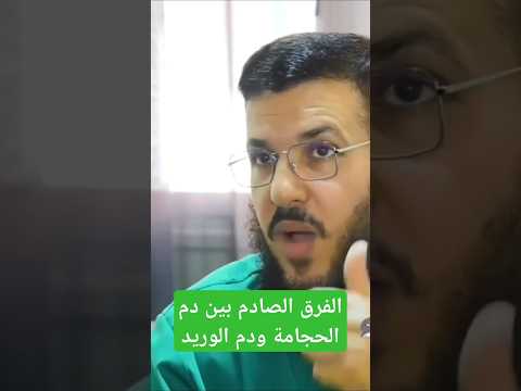 الفرق الصادم بين دم الحجامة ودم الوريد