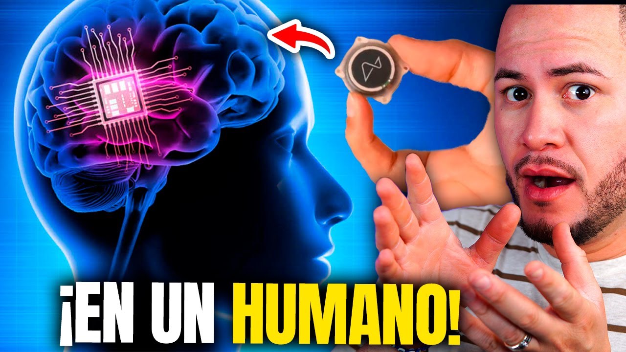 neuralink-ya-pusieron-un-chip-cerebral-en-un-humano-comienza-la