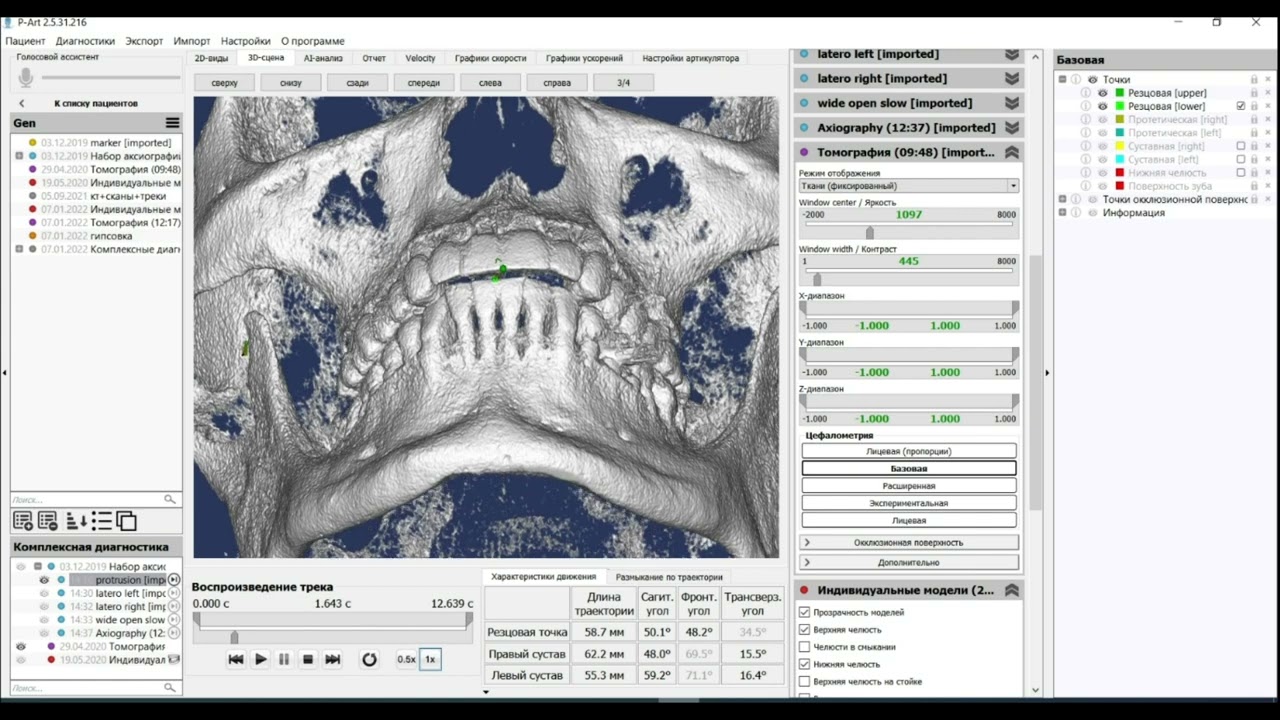 9. Базовая цефалометрия.