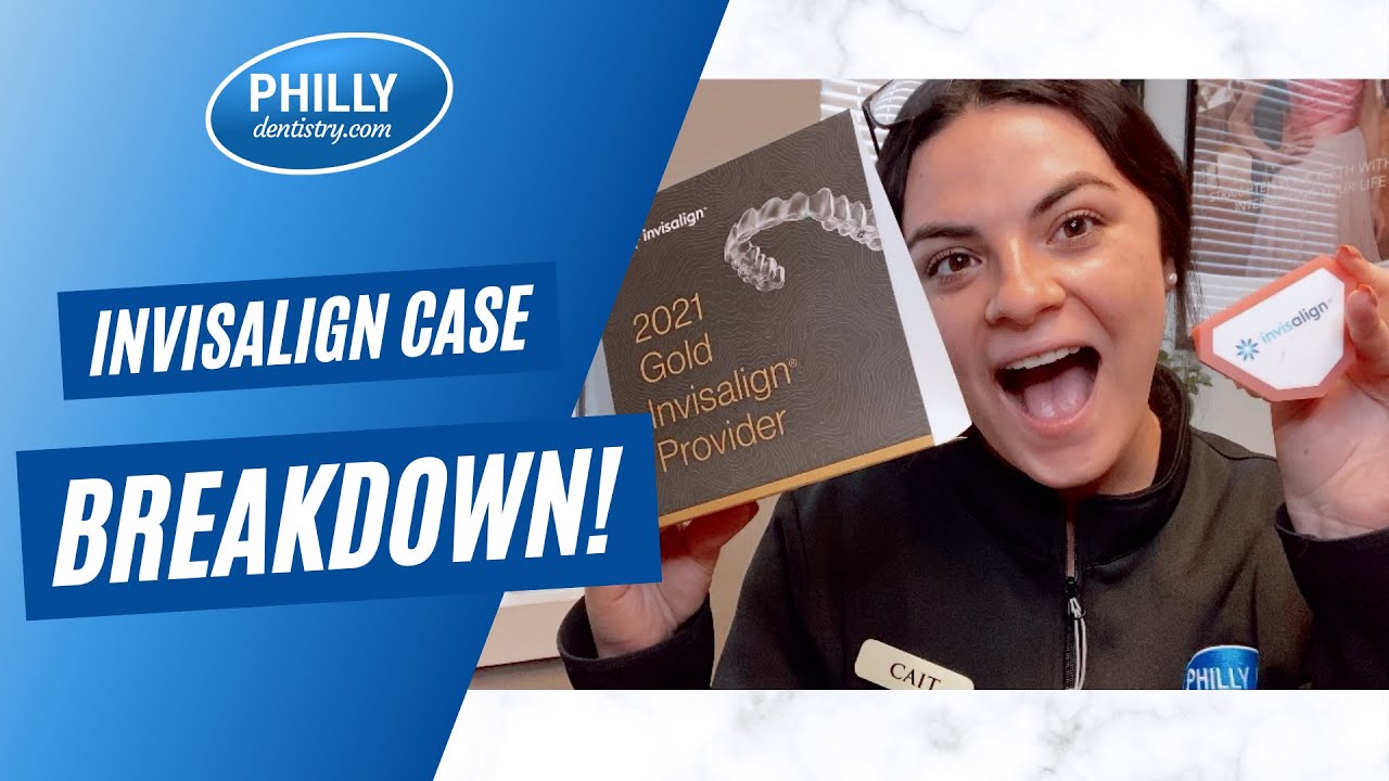 INVISALIGN BREAKDOWN!