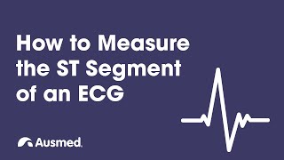 How to Measure the ST Segment of an ECG | Ausmed Explains...