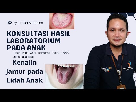 Jamur Anak Di Mulut