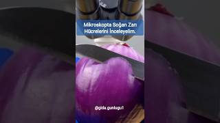 Mikroskopta Soğan Zarı Hücreleri