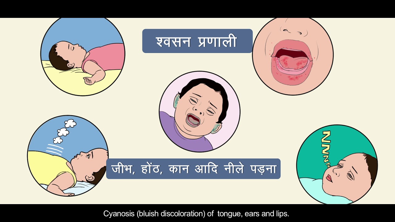 Use of adrenaline injection by ANM II JSI India - YouTube