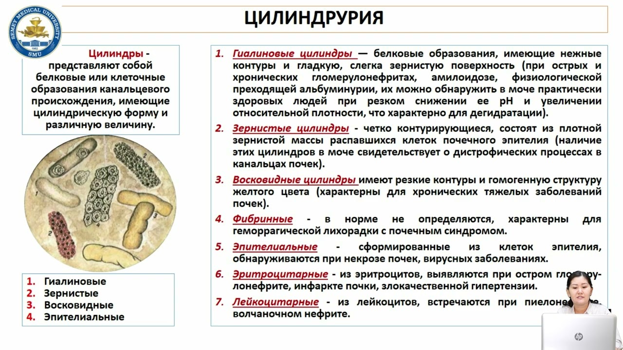 Основные почечные синдромы