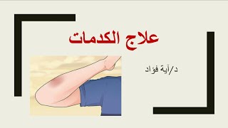 علاج الكدمات بطريقة صحيحة ? How to get rid of bruises