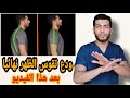 العلاج النهائى والامثل لتقوس الظهر الاتب وانحناء الاكتاف تحدب الظهر عند الاطفال