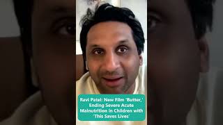 Ravi Patel New Film Er, Ending Severe Acute Malnutrition In Children With This Saves Lives