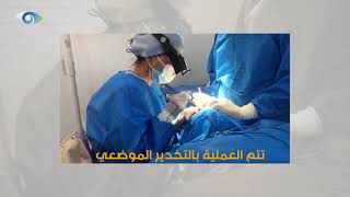 مباشر من صالة العمليات - خطوات اجراء عمليات قص وشد الاجفان التجميلية.