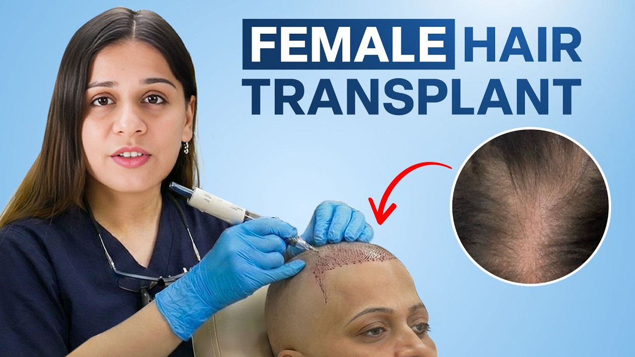 Female Hair Transplant Explained!