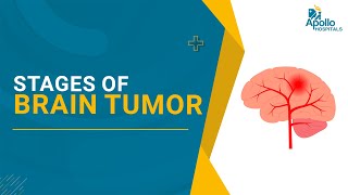 Insightful Guide to the Stages of Brain Tumor | Dr Alok Ranjan, Neurosurgeon | Apollo Hospitals, Hyd