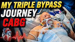 My Triple Bypass Journey. CABG