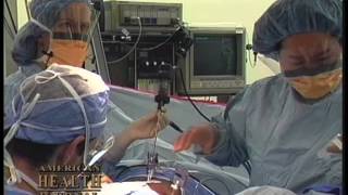 How Is A Laparoscopic Hysterectomy Performed Video
