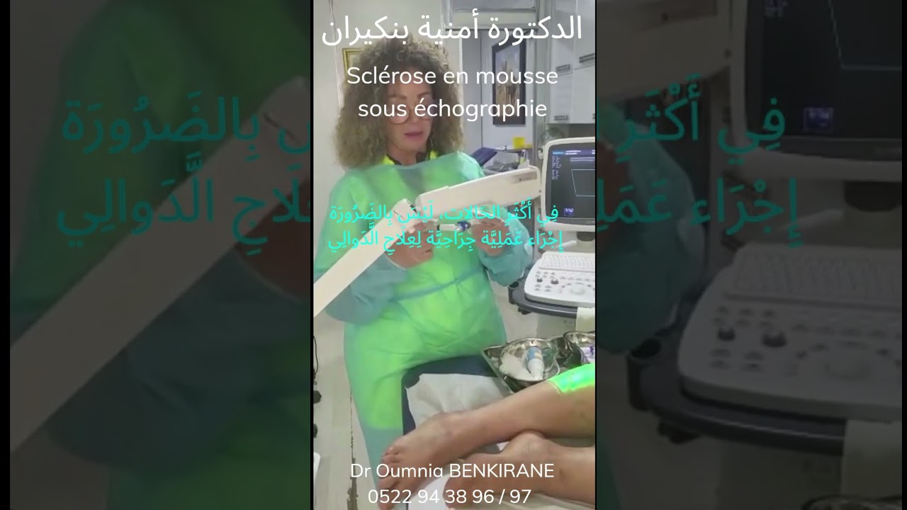 في أكثر الحالات، ليس بالضرورة إجراء عملية جراحية لعلاج الدوالي