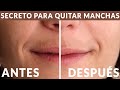 CÓMO ELIMINAR las MANCHAS de la PIEL ✨ | El TRUCO SECRETO de las ESTETICISTAS 💪