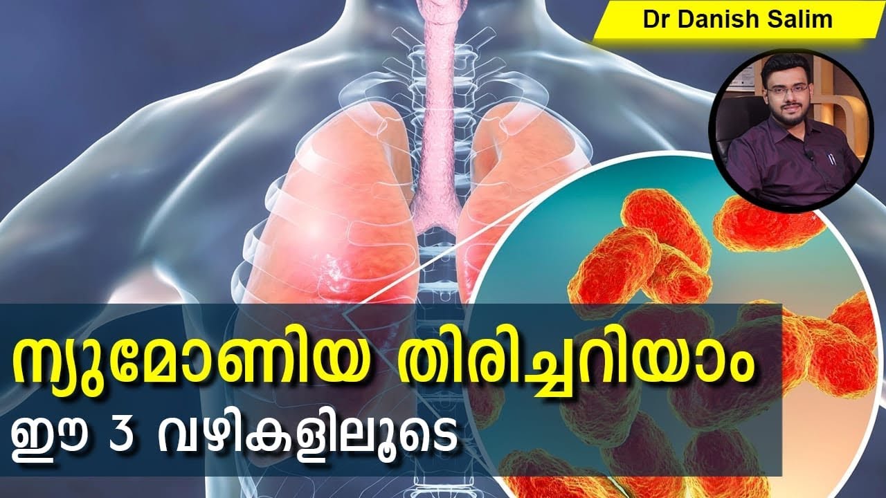 449: ന്യൂമോണിയ തിരിച്ചറിയാനുള്ള 3 വഴികൽ (Identify Pneumonia by 3 Steps)