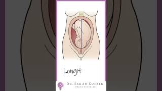 Famous Fetal Lie Profile