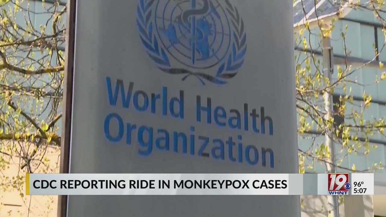 Department of Health and Human Services talks about Monkeypox - WHNT News 19