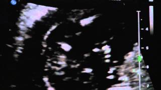 And Baby Showalter Is....