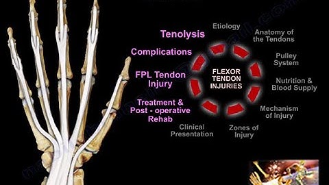 Flexor Tendon Injuries Treatment - Everything You Need To Know - Dr. Nabil Ebraheim