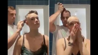 Man goes bald after shaving girlfriend's head who suffers from Alopecia