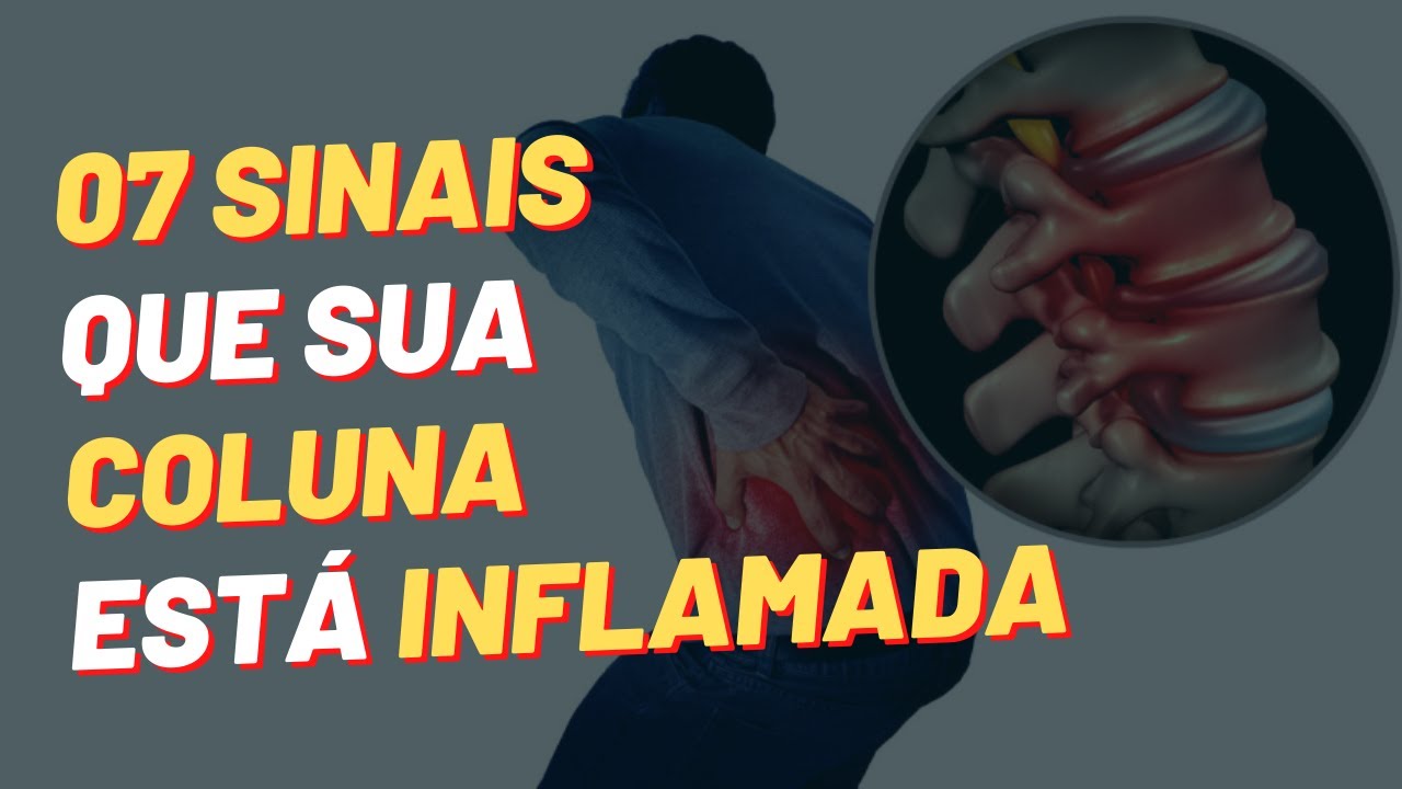 07 Sinais Que Sua Coluna Est Inflamada