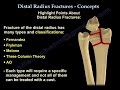 Distal Radius Fractures - Everything You Need To Know - Dr. Nabil Ebraheim