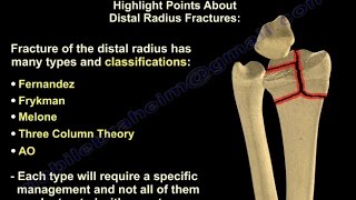 Distal Radius Fractures - Everything You Need To Know - Dr. Nabil Ebraheim