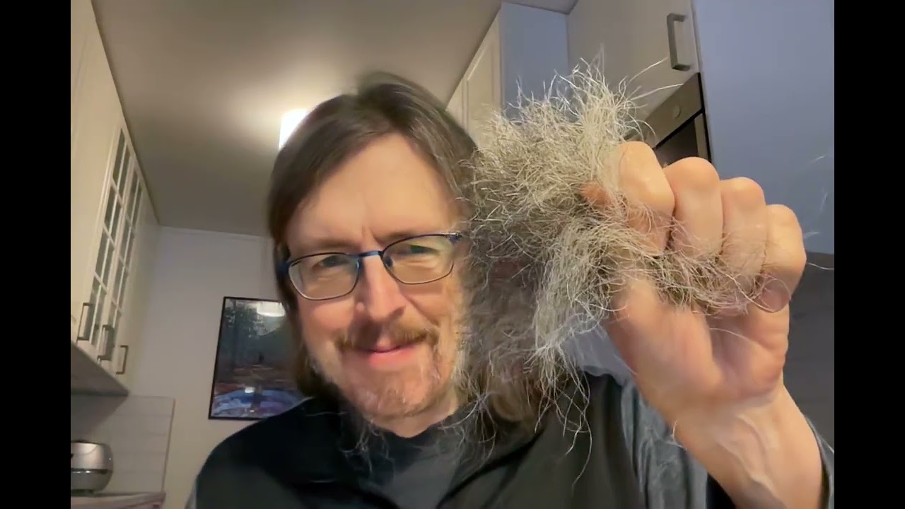 2026 01 15 Transgender surgery