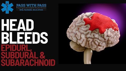 Head Bleeds: Epidural, Subdural & Subarrachnoid | A Quick Review!